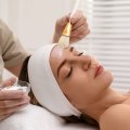 Tips for Combining Natural Skincare with Laser and Chemical Peels